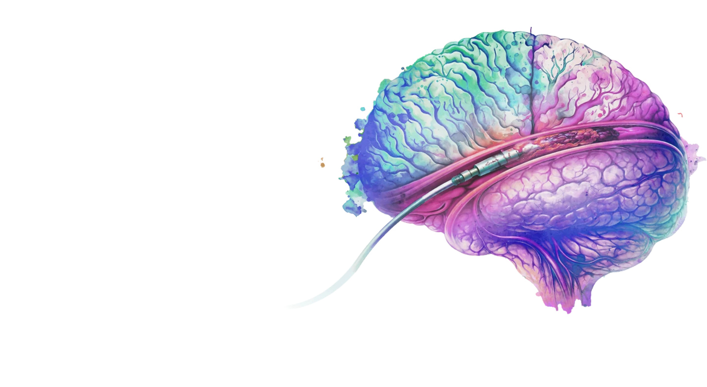 Brain image